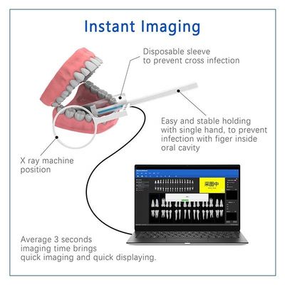 Multifunctionele de X Ray Tandmachine van USB, Draadloze Handbediende Tandröntgenstraaleenheid