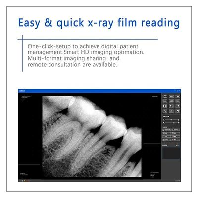 Multifunctionele de X Ray Tandmachine van USB, Draadloze Handbediende Tandröntgenstraaleenheid