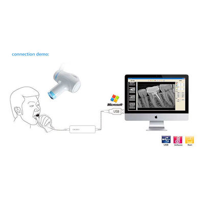 De handbediende Draagbare Tandbehandeling van X Ray Machine Camera For Endodontic