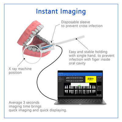 Digitale sensor voor tandheelkundige röntgenstraling voor tandheelkundige implantaten en endodontische behandeling