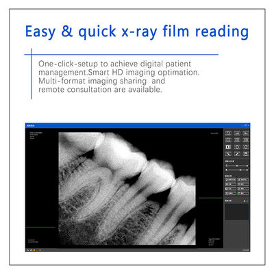 Digitale sensor voor tandheelkundige röntgenstraling voor tandheelkundige implantaten en endodontische behandeling