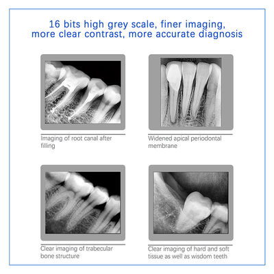 Digitale sensor voor tandheelkundige röntgenstraling voor tandheelkundige implantaten en endodontische behandeling
